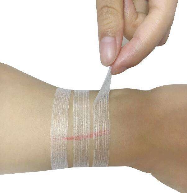 Wound Closure Strip